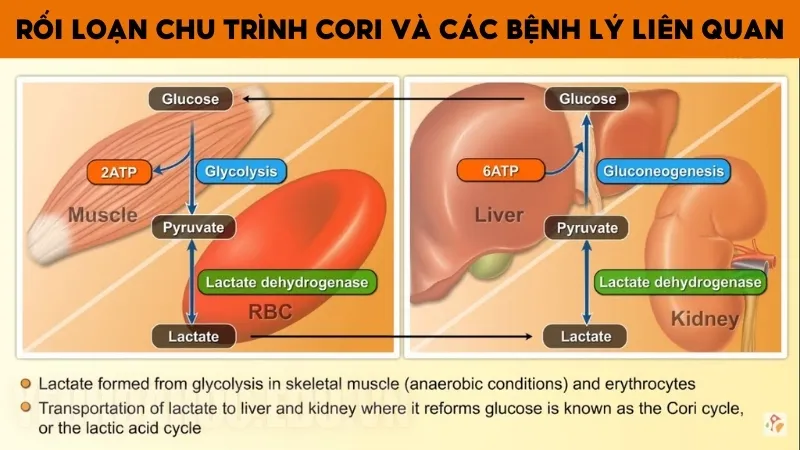 Rối loạn chu trình Cori và các bệnh lý liên quan