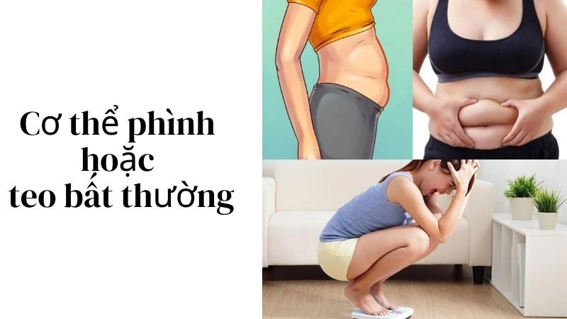 Cơ thể “phình” hoặc “teo” bất thường vì giữ nước và rối loạn nội tiết