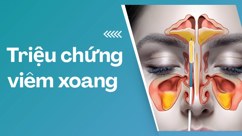 Đau nhức “lạ” mà ai cũng từng gặp nhưng không để tâm