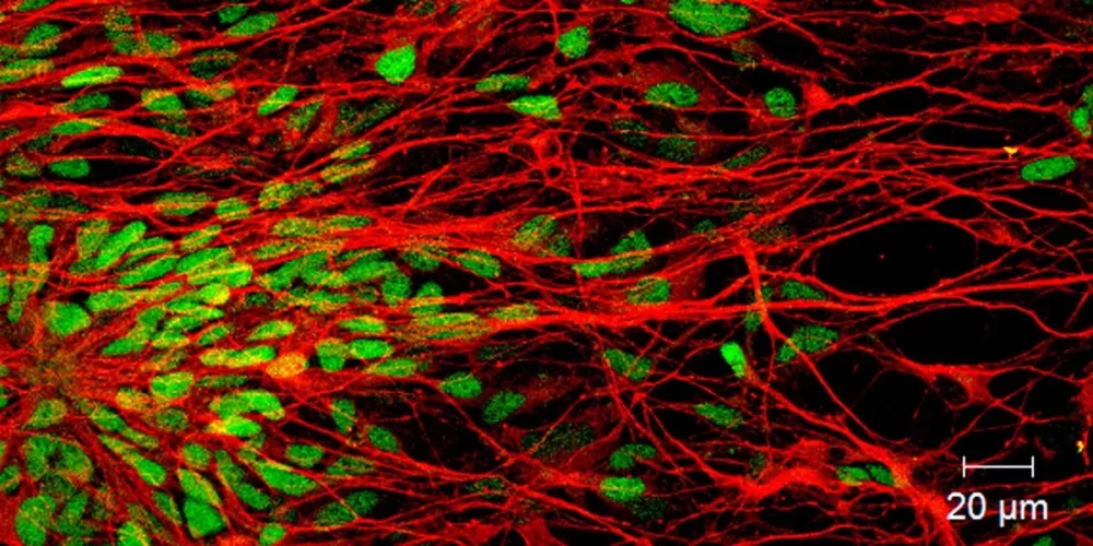 Cấu tạo nơ-ron thần kinh chi tiết dưới kính hiển vi điện tử