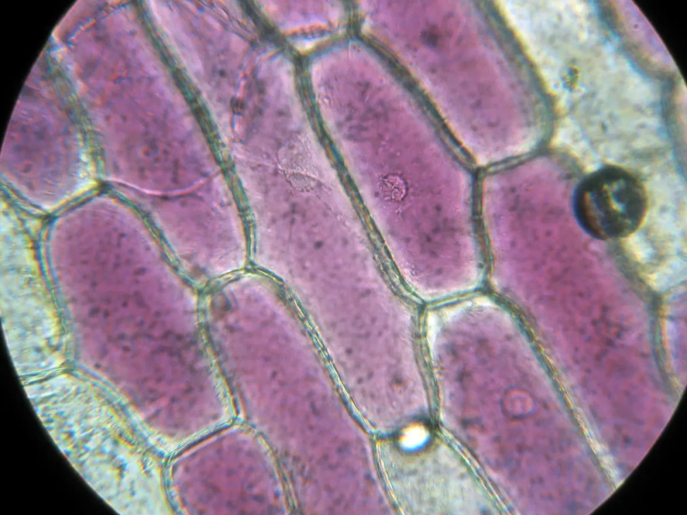 Soi tế bào thực vật dưới kính hiển vi để thấy vách tế bào cellulose