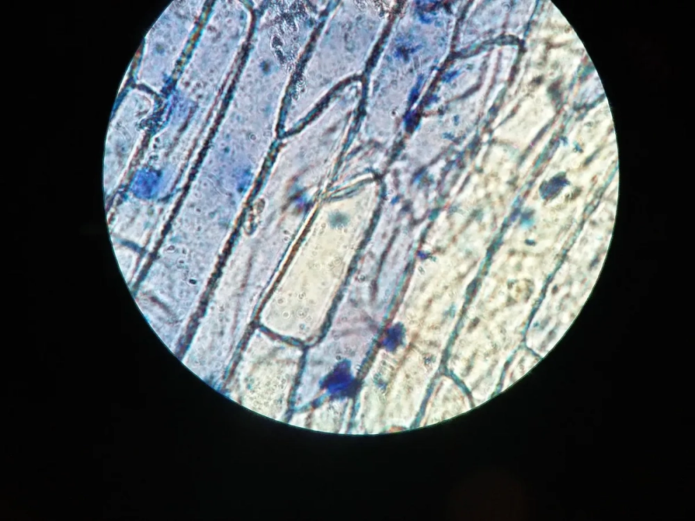 Cấu tạo chi tiết của tế bào thực vật dưới kính hiển vi quang học với thành tế bào và lục lạp rõ nét